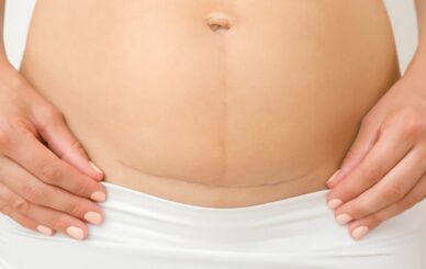 Lợi ích Và Tác Hại Của Sanh Mổ